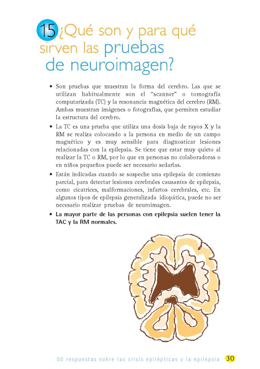 50 Respuestas sobre las crisis epilÃ©pticas y la epilepsia PÃ¡gina 25