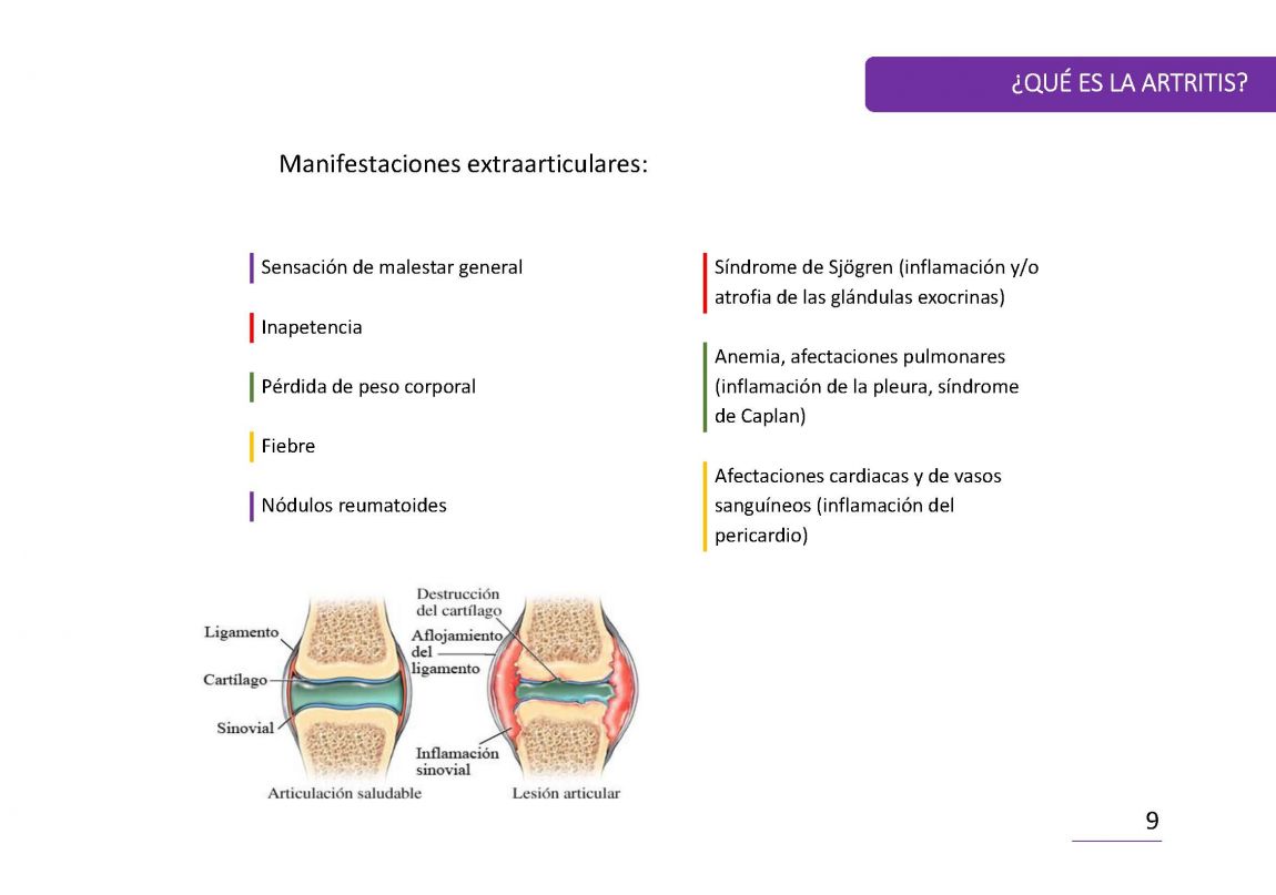 ArtritisReumatoide PaÌgina 09