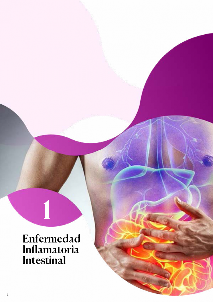 guia enfermedad inflamatoria intestinal Página 04