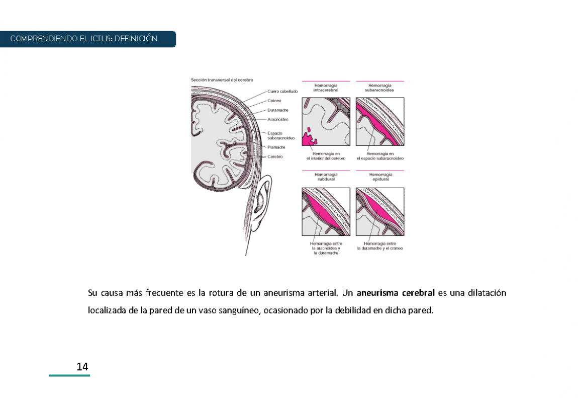 Ictus Guia para Pacientes Página 014